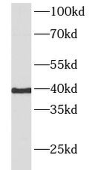 HTR4 Rabbit Polyclonal Antibody
