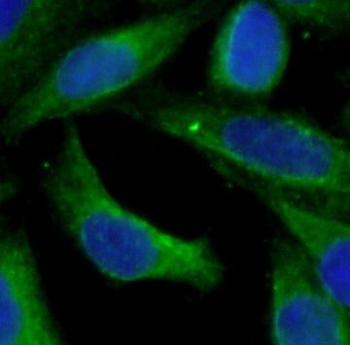 HTR4 Rabbit Polyclonal Antibody