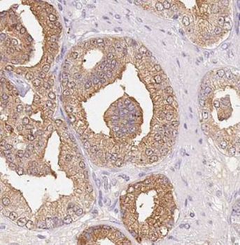 HTR4 Rabbit Polyclonal Antibody