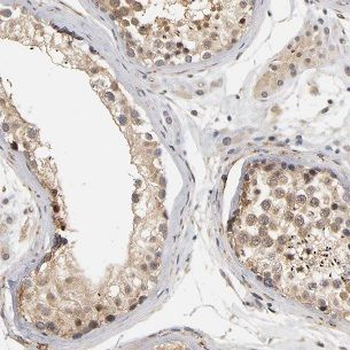 HYDIN Rabbit Polyclonal Antibody