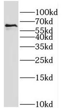 PTPRN Rabbit Polyclonal Antibody
