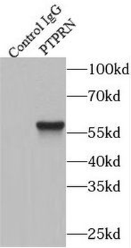 PTPRN Rabbit Polyclonal Antibody