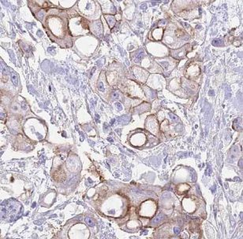 PTPRN Rabbit Polyclonal Antibody
