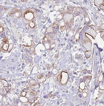 PTPRN Mouse Monoclonal Antibody
