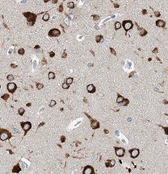 ICA1L Rabbit Polyclonal Antibody