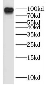 ICAM1 Rabbit Polyclonal Antibody