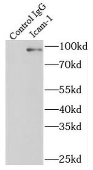 ICAM1 Rabbit Polyclonal Antibody