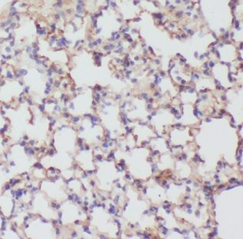 ICAM1 Rabbit Polyclonal Antibody