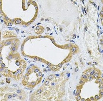ICOSLG Rabbit Polyclonal Antibody