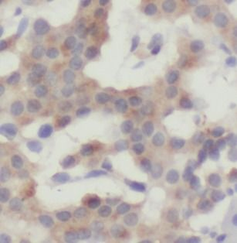 IDH1 Mouse Monoclonal Antibody