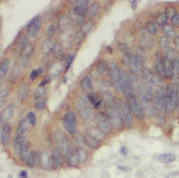 IDH2 Rabbit Polyclonal Antibody