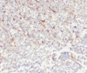 IDO1 Rabbit Polyclonal Antibody