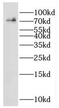 IDUA Rabbit Polyclonal Antibody