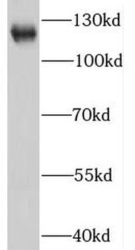 IFIH1 Rabbit Polyclonal Antibody