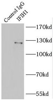 IFIH1 Rabbit Polyclonal Antibody
