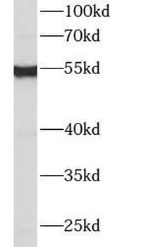 IFIT2 Rabbit Polyclonal Antibody