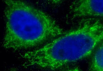 IFIT2 Rabbit Polyclonal Antibody
