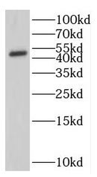 IFIT5 Rabbit Polyclonal Antibody
