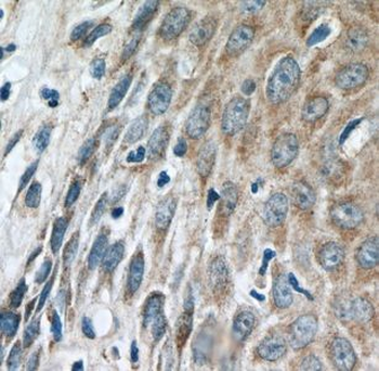 IFIT5 Rabbit Polyclonal Antibody