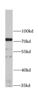 IFNAR1 Rabbit Polyclonal Antibody