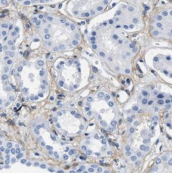 IFNAR1 Rabbit Polyclonal Antibody