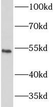 IFNAR2 Rabbit Polyclonal Antibody
