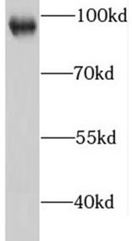 IFNGR1 Rabbit Polyclonal Antibody