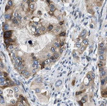 IFNGR1 Rabbit Polyclonal Antibody