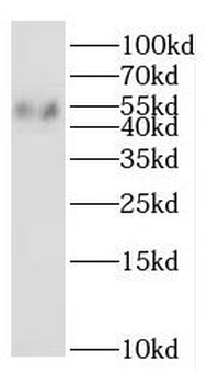 IFNGR2 Rabbit Polyclonal Antibody
