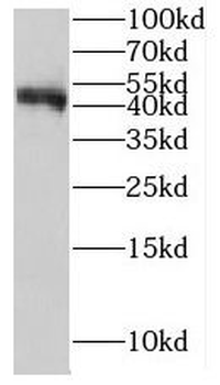 IFT57 Rabbit Polyclonal Antibody