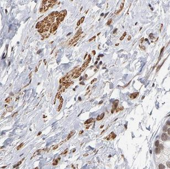 IFT57 Rabbit Polyclonal Antibody