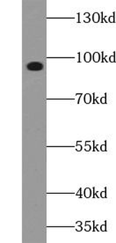 IFT88 Rabbit Polyclonal Antibody