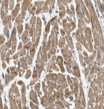 IFT88 Rabbit Polyclonal Antibody
