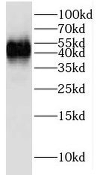 IGBP1 Rabbit Polyclonal Antibody