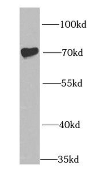 IGF2BP1 Rabbit Polyclonal Antibody