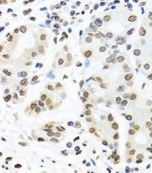 IGF2BP1 Rabbit Polyclonal Antibody