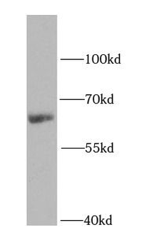 IGF2BP2 Rabbit Polyclonal Antibody
