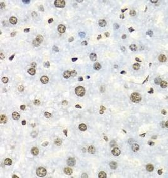 IGF2BP2 Rabbit Polyclonal Antibody