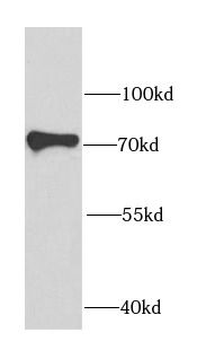 IGF2BP3 Rabbit Polyclonal Antibody