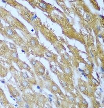 IGF2BP3 Rabbit Polyclonal Antibody