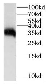 IGFBP1 Rabbit Polyclonal Antibody