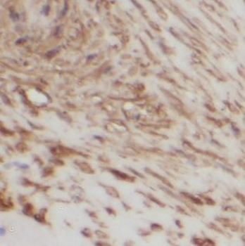 IGFBP1 Rabbit Polyclonal Antibody
