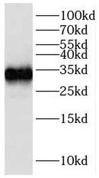 IGFBP2 Rabbit Polyclonal Antibody