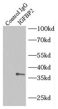 IGFBP2 Rabbit Polyclonal Antibody