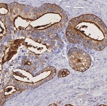 IGFBP2 Rabbit Polyclonal Antibody