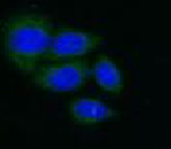 IGFBP3 Rabbit Polyclonal Antibody