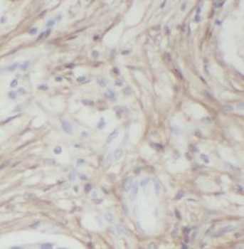 IGFBP3 Rabbit Polyclonal Antibody