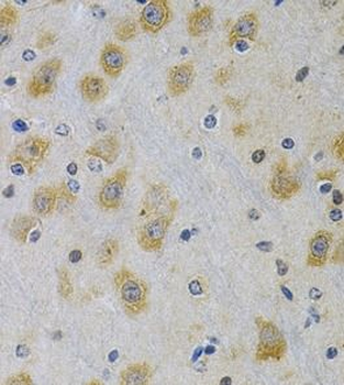 IGFBP4 Rabbit Polyclonal Antibody