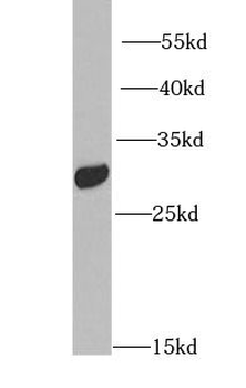 IGFBP5 Rabbit Polyclonal Antibody