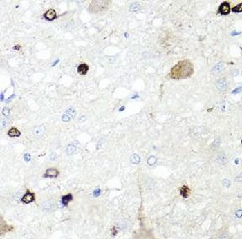 IGFBP5 Rabbit Polyclonal Antibody